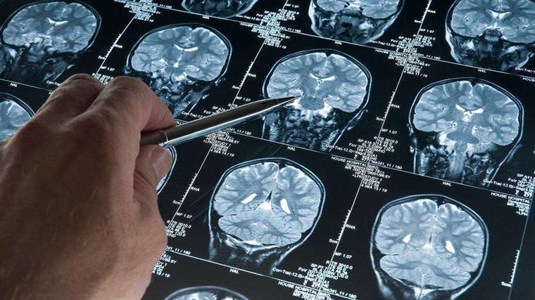 Derin uyku Alzheimer'ı yavaşlatıyor