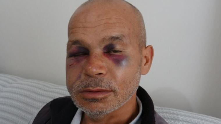 Engelli adamı darbeden şüpheli serbest bırakıldı